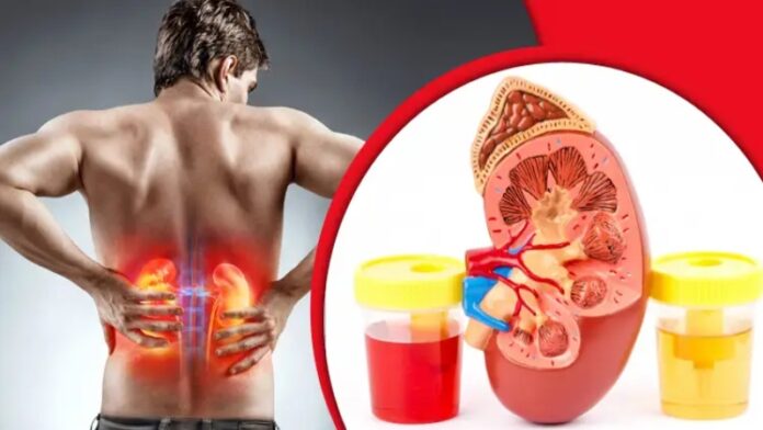 4pick-20230804115820-2511170348